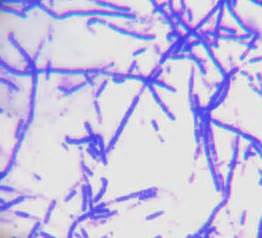 Gram positive bacteria are cells that take up a purple color in the gram stain procedure. How can I identify these three types of gram positive ...