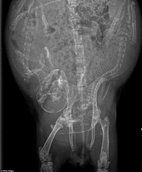 Pregnant X Ray Telegraph