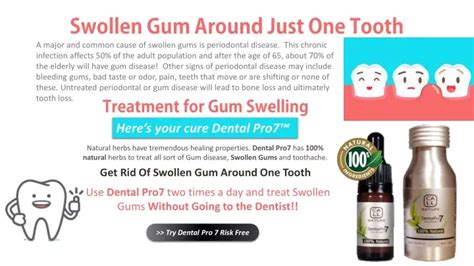 Ppt Swollen Gum Around One Tooth No Pain Powerpoint Presentation