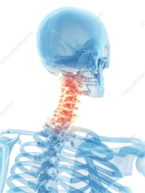 The anatomical neck of the humerus is only a slight constriction, while the neck of the femur is a very distinct portion, running from the head to meet the shaft. Human neck bones, artwork - Stock Image - F009/4097 - Science Photo Library