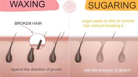 Sugaring Vs Waxing Which Hair Removal Method Lasts Longer