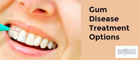 Gum Disease Treatment Options Is Locked Gum Disease Treatment Options