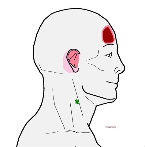 Understanding Trigger Points Headache In The Forehead Headache