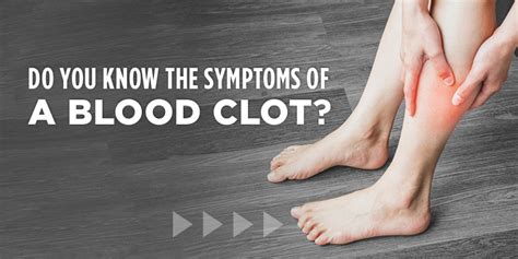 Deep Vein Thrombosis Symptoms Of Blood Clots Neighbors Emergency Center