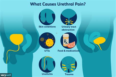 Urethral Pain Causes Treatment When To See A Doctor