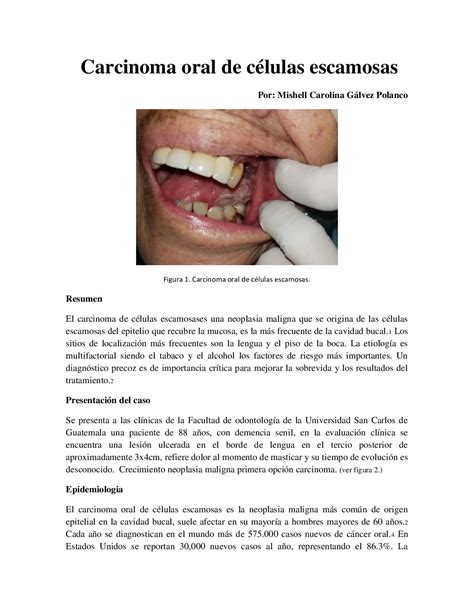 Calaméo Carcinoma Oral De Celulas Escamosas Docx