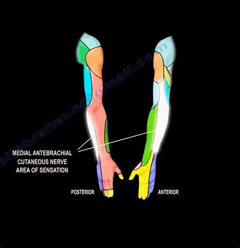 Medial Antebrachial Cutaneous Nerve Injury —