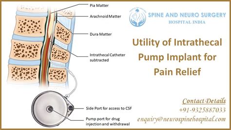 Pin On Spine And Neuro Surgery Hospital India