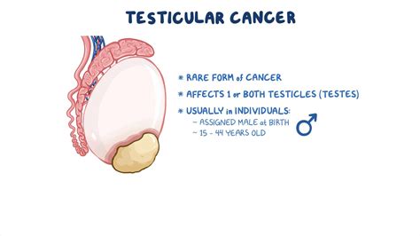 Testicular Cancer Nursing Osmosis Video Library