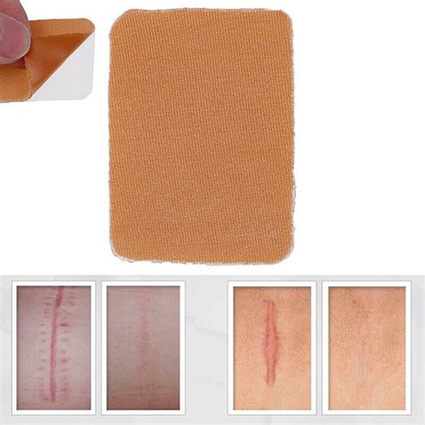 Silicone Gel Scars Away Patch Reusable Removal Cesarean Scar Treatment Potent Removal Scar