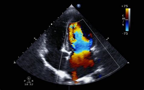 Echocardiogram Ultrasound Kymera Independent Physicians