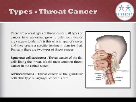 Ppt What Is Throat Cancer And Its Awareness University Cancer
