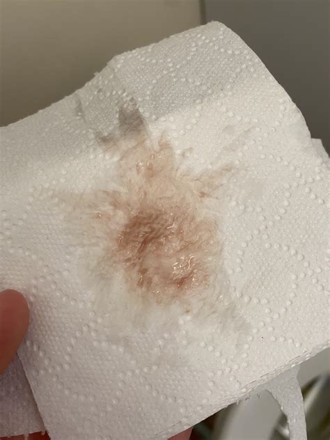 Did Anyone Else Experience Random Spottingbrown Discharge When Getting