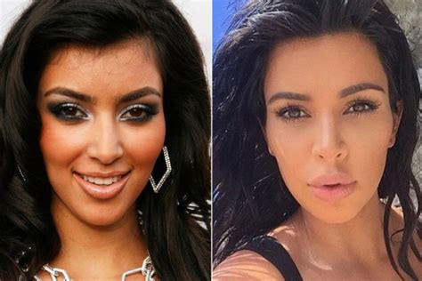 Kim Kardashian Before And After Experts Have Their Say On Speculated