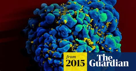 People With Hiv Live Almost 20 Years Longer Than In 2001 Global
