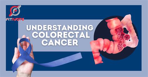 Understanding Colorectal Cancer Fitivate