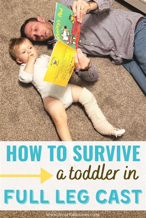 How To Survive A Toddler With A Broken Leg In 2020 Broken Leg