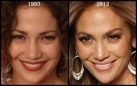 Jennifer lopez and wisin, yandel, casper magico, nio garcia, cosculluela te bote ii (2018). Jennifer Lopez then and now, before and after (1993, 2012 ...