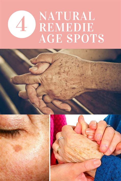 4 Diy Natural Remedies Ways To Remove Age Spots Age Spot Removal