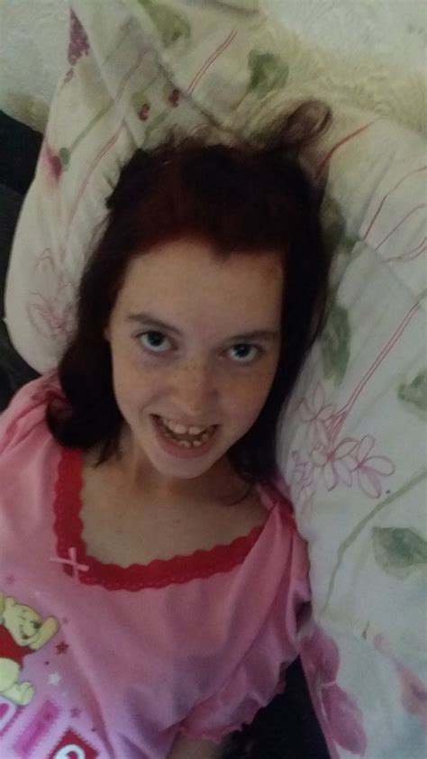 Crowdfunding To Get A Buggy For My 18 Year Old Sister On Justgiving