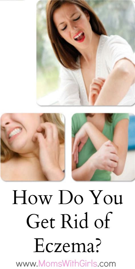 How Do You Get Rid Of Eczema Getridofwrinklescream Get Rid Of Eczema Eczema Treatment Eczema