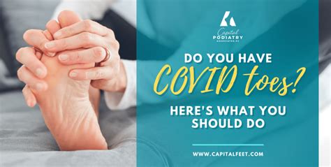 How To Tell If You Have Covid Toes And What You Should Do To Treat Them