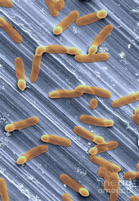 Clostridium Difficile Bacteria Photograph By Scimat Pixels