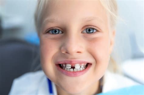 Does My Child Need Braces Cordes Orthodontics