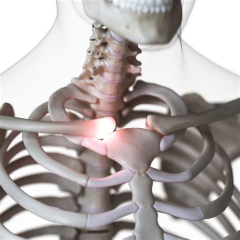Sternoclavicular Joint Injury Shoulder Specialist South Windsor