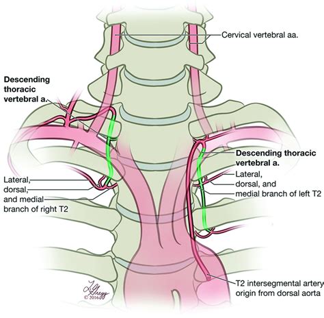 Ascending And Descending Thoracic Vertebral Arteries American Journal