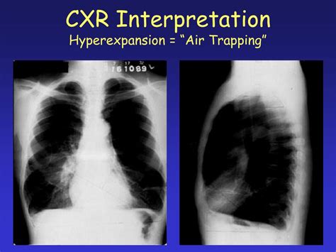 Ppt Introduction To Radiographic Interpretation Special Emphasis On