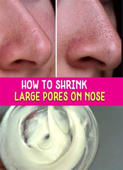 Shrink Large Pores On Nose Agespotsbeautytips Poresstrips Large