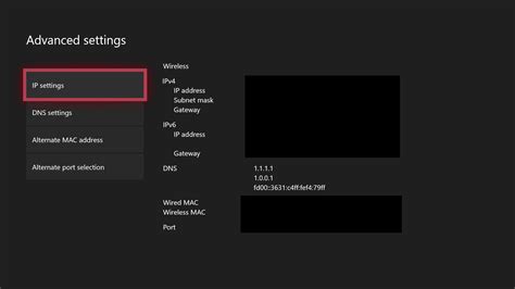 How To Change Xbox One Dns To Boost Network Speed And Privacy Windows