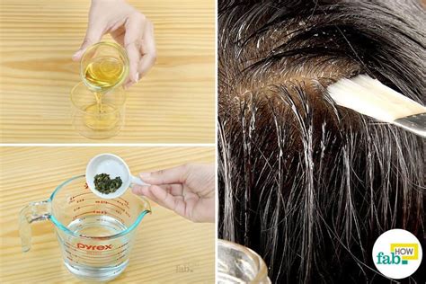 Itchy Scalp Causes With Hair Loss Treatments Remedies