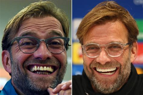 Jürgen klopp hat gut lachen: Has Jurgen Klopp had his teeth done? Liverpool boss ...
