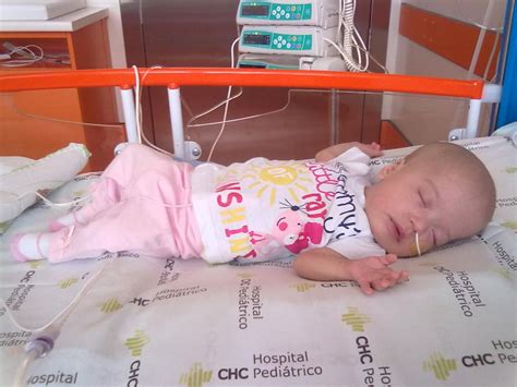 Check spelling or type a new query. Zellweger syndrome with severe malnutrition ...
