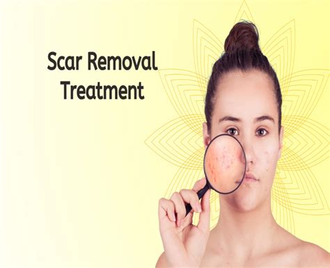 Acne Scar Removal Tvak Laser Clinic