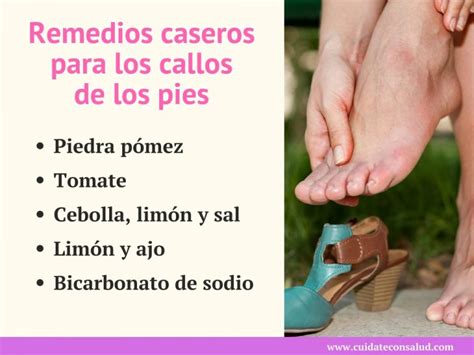 Remedios Caseros Para Quitar Los Callos De Los Pies