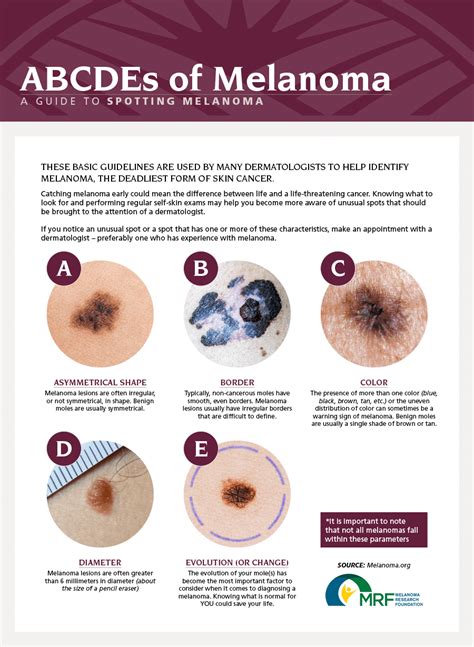 What Are The Different Types Of Malignant Melanoma