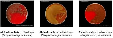Blood Agar Composition Preparation Uses And Pictures