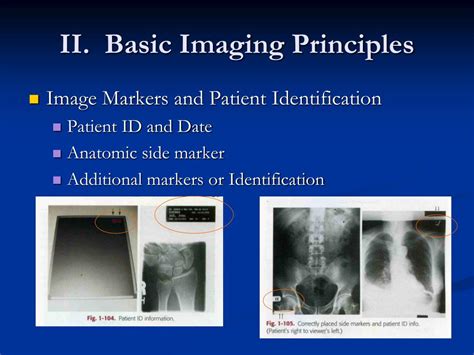 PPT Introduction Of Radiographic Technology PowerPoint Presentation Free Download ID