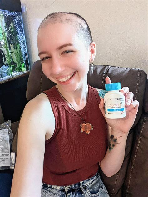 After Battling Cicatricial Alopecia For 10 Years I Finally Received The