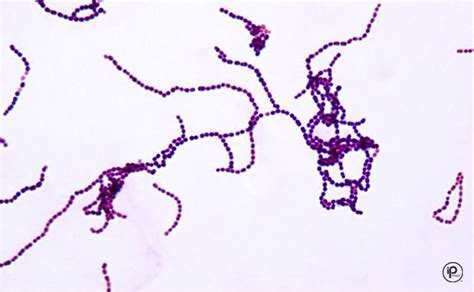 Gram Positive Cocci In Clusters