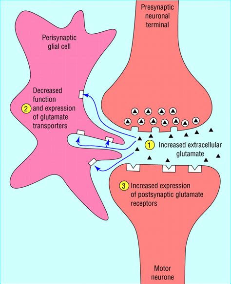 motor neurone disease the bmj