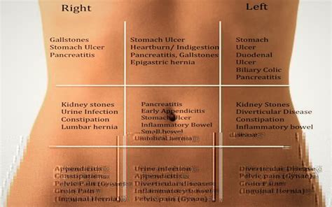What Is Making Your Stomach Hurt Find Out Using This Stomach Ache Map