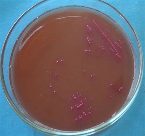 On Salmonella Shigella Agar The E Coli Produced Slight Pinkish