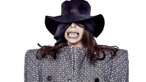 Lady Gaga Oddball Singer Sports Bizarre Set Of Dirty False Teeth For
