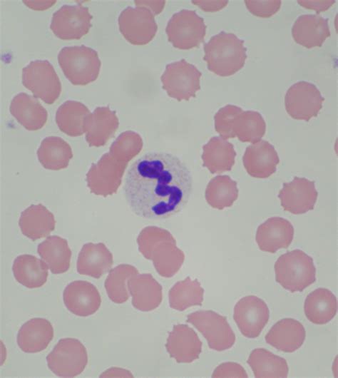 Healthy White Blood Cells Biological Science Picture Directory