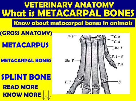 Bones Of Metacarpus Gross Anatomy Anjani Mishra