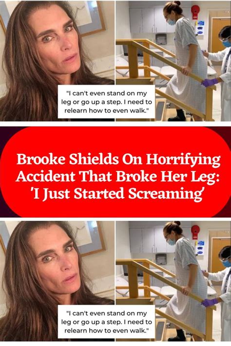 Brooke Shields On Horrifying Accident That Broke Her Leg I Just Started Screaming In 2023